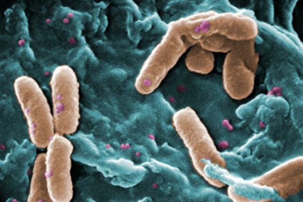 Nanogel technology from Welsh university destroys drug-resistant bacteria