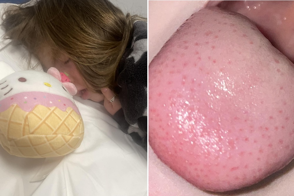 Parents urged to watch for scarlet fever symptoms as strep A cases surge in  Queensland - ABC News