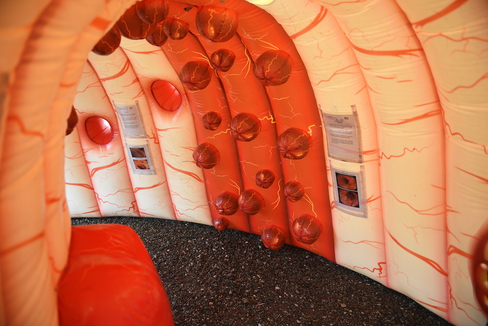 giant-inflatable-bowel-to-tour-cardiff-to-raise-cancer-awareness